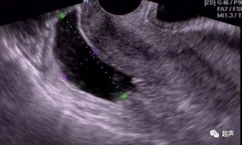 1695189476654515.jpg a6a915993d026c2d5bf2085f744a4632.jpg